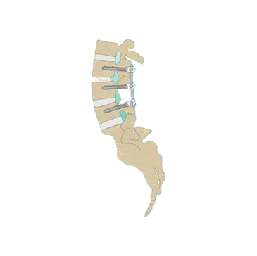 SPINE