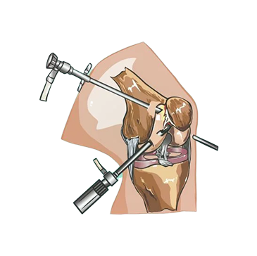Sports Medicine