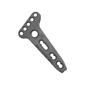 LCP Volar Buttress Plate 2.7mm (Head 5 Hole) (Left & Right)