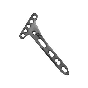 LCP Volar Distal Radius Plate 2.7mm (Head 5 Hole) (Left & Right)