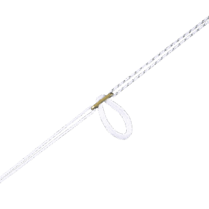 Loop Loc – CL Fixation System