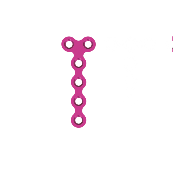 T Plate 1.5mm