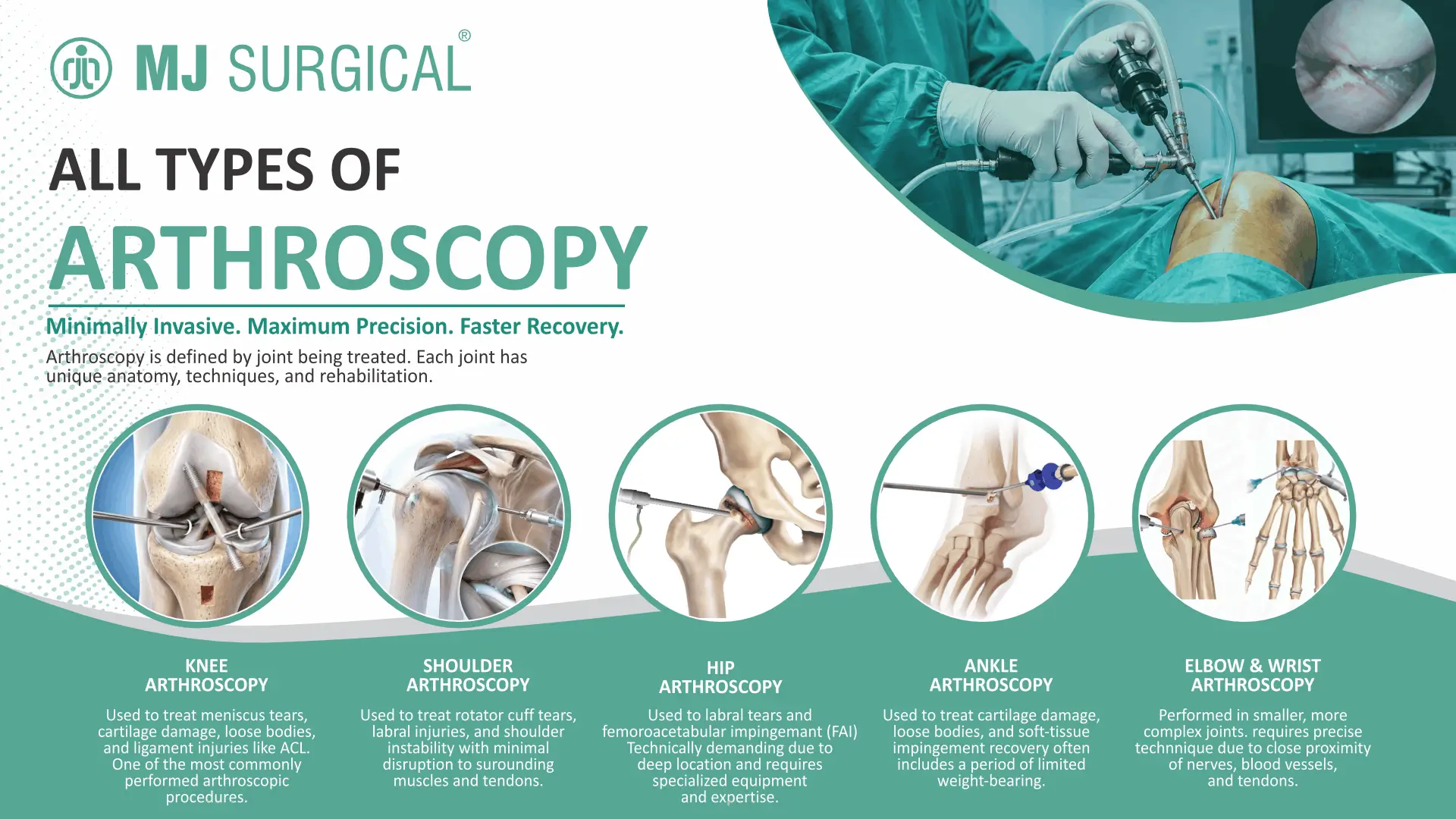 Infographic by MJ Surgical detailing all types of arthroscopy, including anatomical illustrations and descriptions for knee, shoulder, hip, ankle, and elbow and wrist joint procedures.